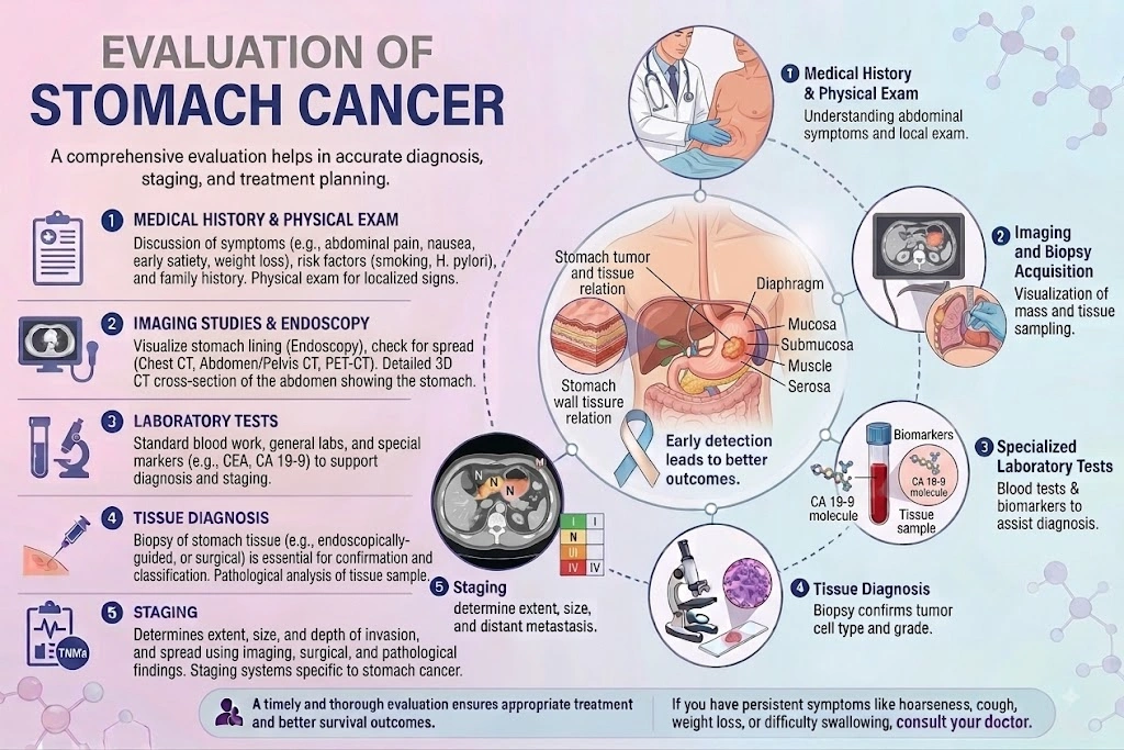 Evaluation of Stomach Cancer