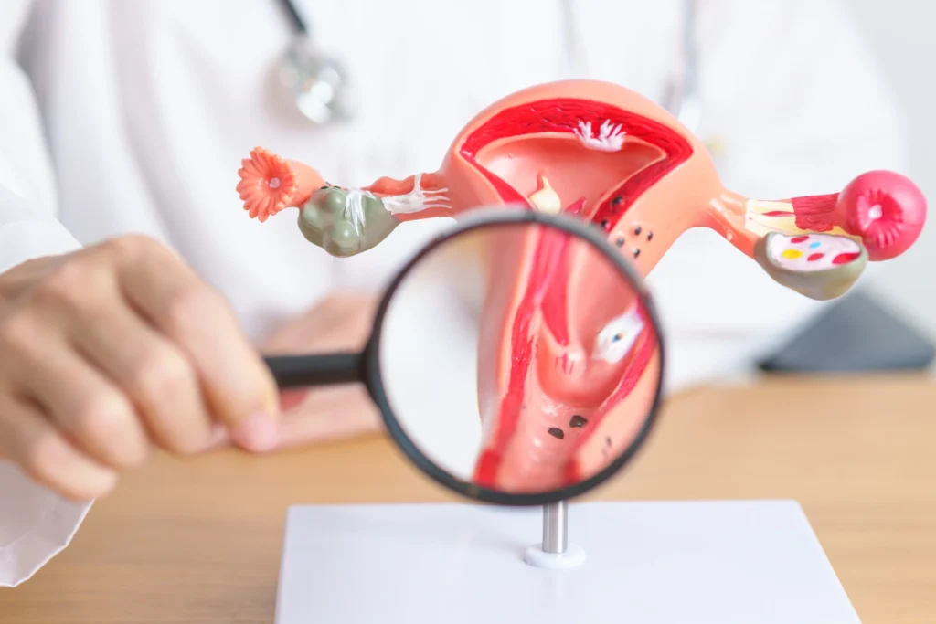 What Is Cervical Cancer?
