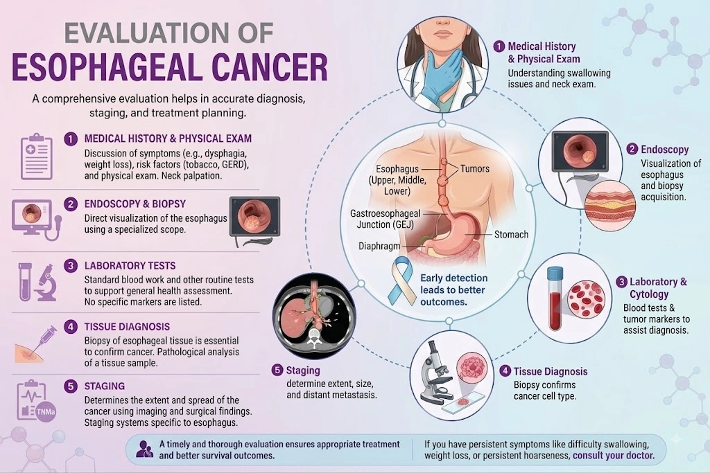 Evaluation of Esophageal Cancer