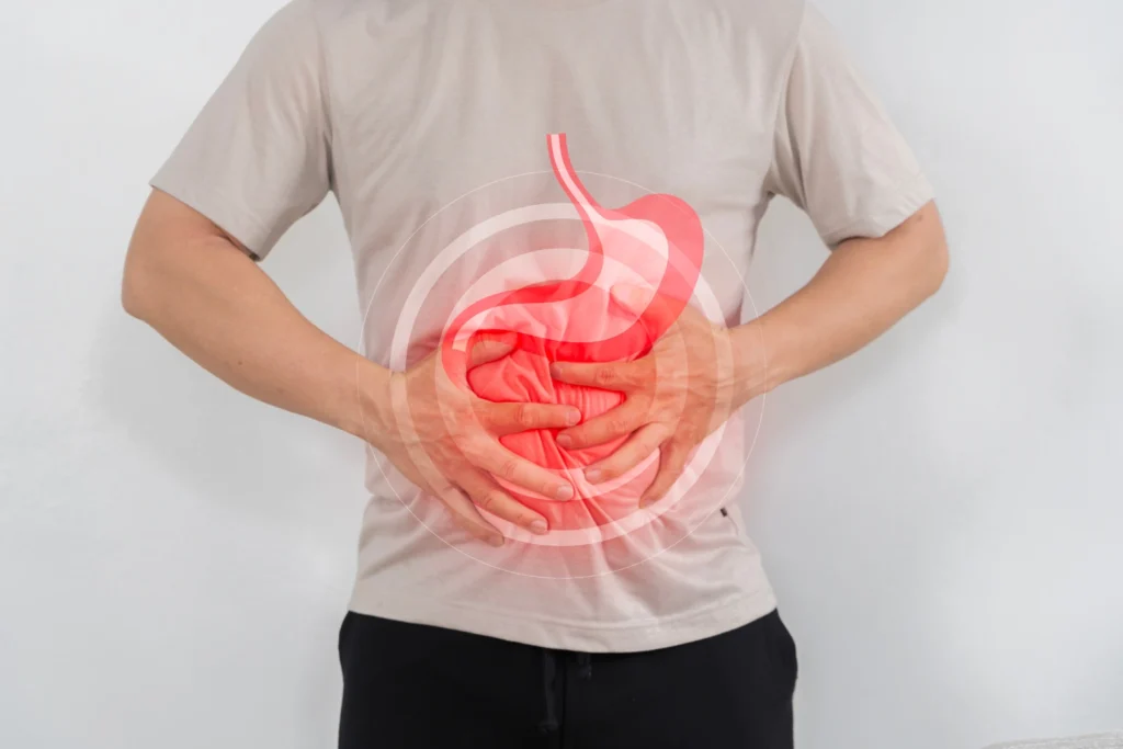 What Is Rectal Cancer?