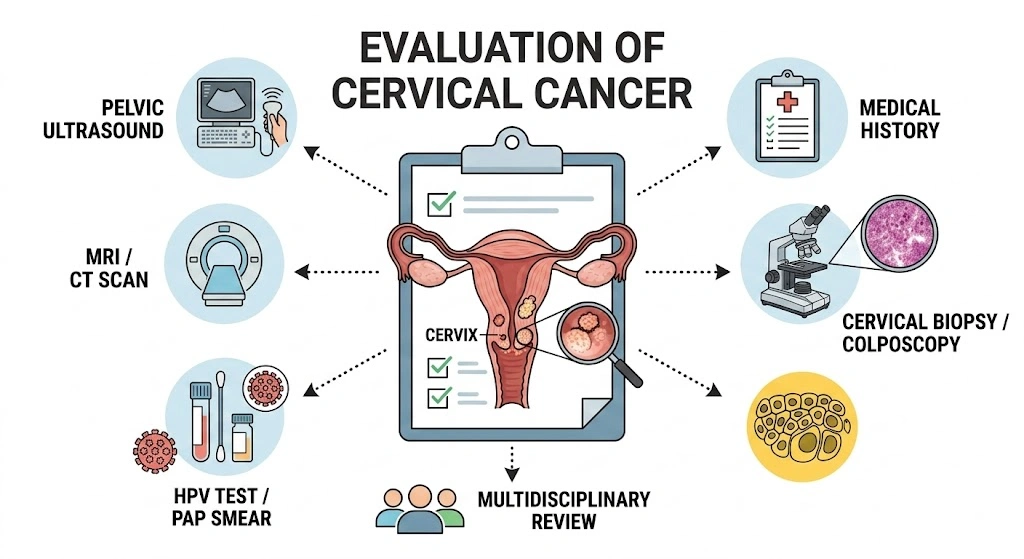 Evaluation of Cervical Cancer